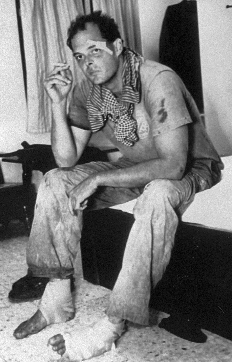 American journalist Nate Thayer sits bandaged in a hotel room on Oct. 15, 1989 in Aranyaprathet, Thailand, after he was injured in a land mine explosion while returning from Cambodia. Credit: Associated Press