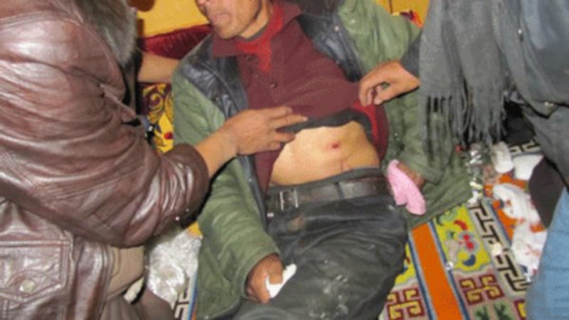 tibet-gunshot-stomach-400.gif