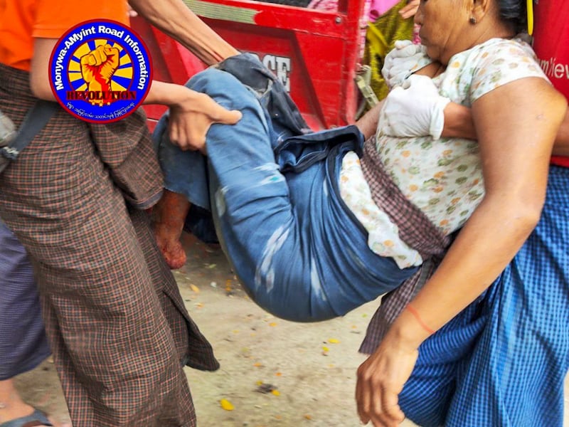 A local woman was injured by an artillery shell in Hta Naung Taw (South) village of Monywa township, Sagaing region, Aug. 13, 2024. (@MomywaAMyintRoadInformation via Telegram)