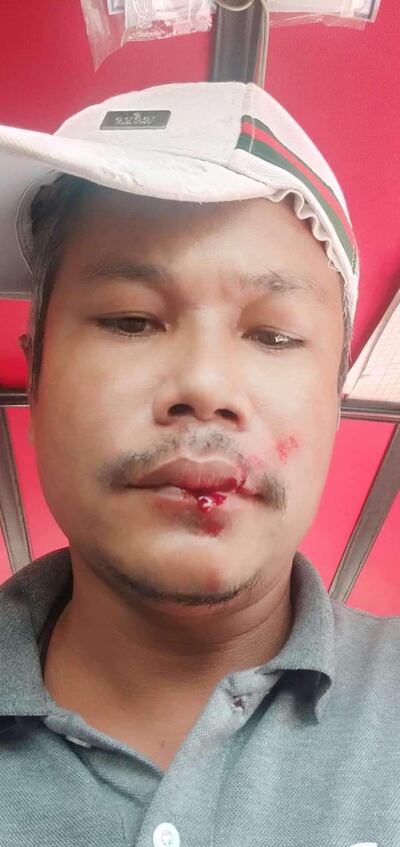 Prak Seiha in a photo after being bludgeoned with a rock by unknown assailant in Phnom Penh, Feb. 16, 2021. Facebook