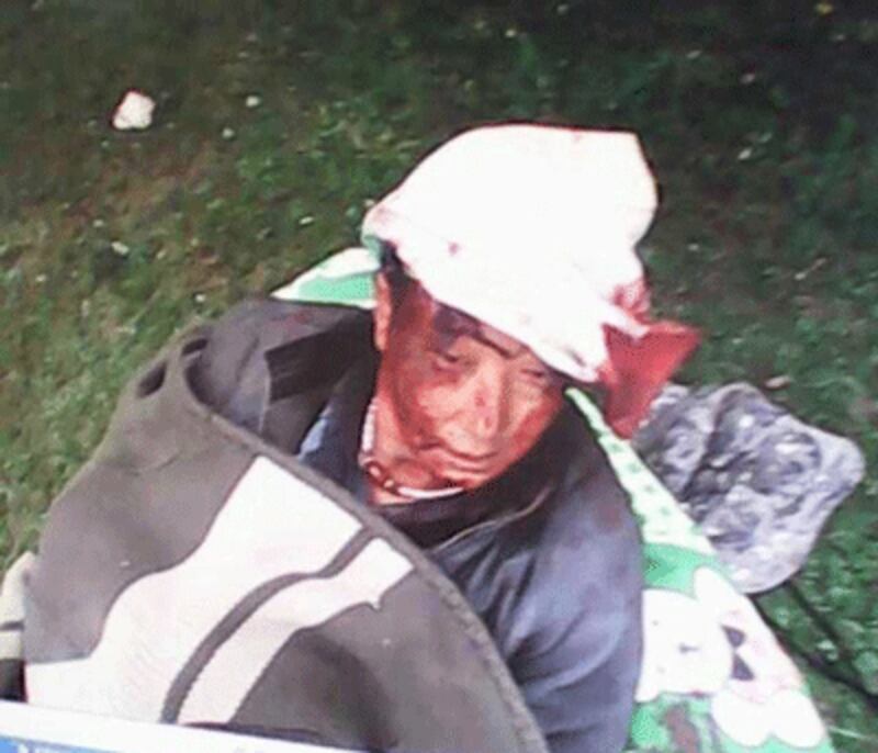 Another unidentified Tibetan wounded in the attack.