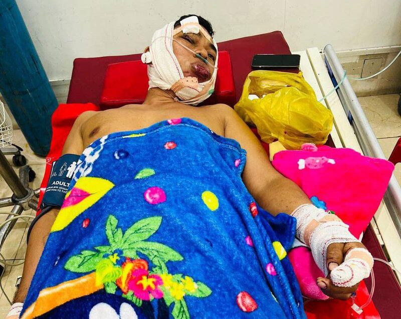 Ny Nak, who was recently freed after being jailed for criticizing Cambodia’s COVID-19 restrictions, is being treated in a private clinic after being beaten by people wielding metal batons. (Facebook/Ny Nak)