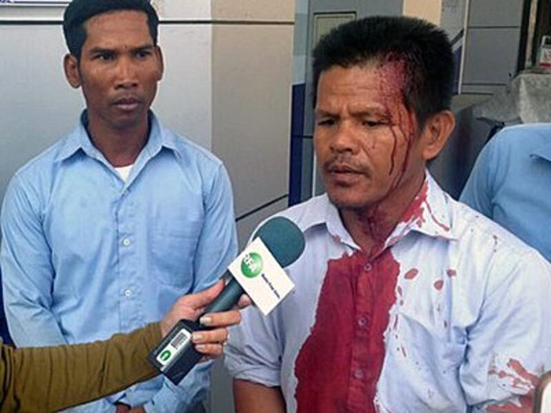 A former Capitol Tours bus driver who was beaten during a protest talks to reporters in Phnom Penh, Feb. 6, 2016.