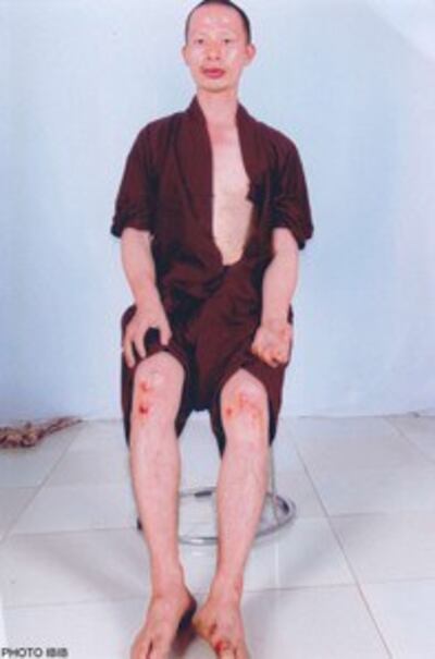 Thich Quang Thanh shortly after being beaten by police on June 10, 2012. Photo courtesy of Vietnam Committe on Human Rights.