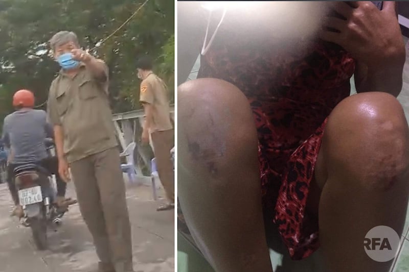 Trinh’s knees were scratched after struggling with authorities to get back her husband’s phone. Credit: Tieng Dan Television