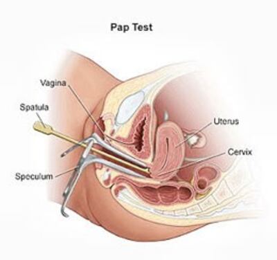 Xét nghiệm Pap Smear. Wikipedia