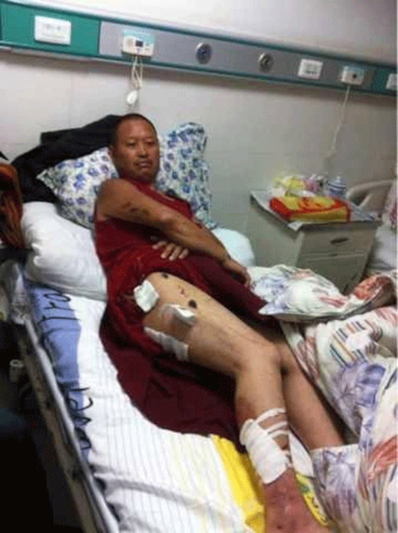 Monk Tsewang Choephel shows the gunshot wounds he sustained in the police attack.