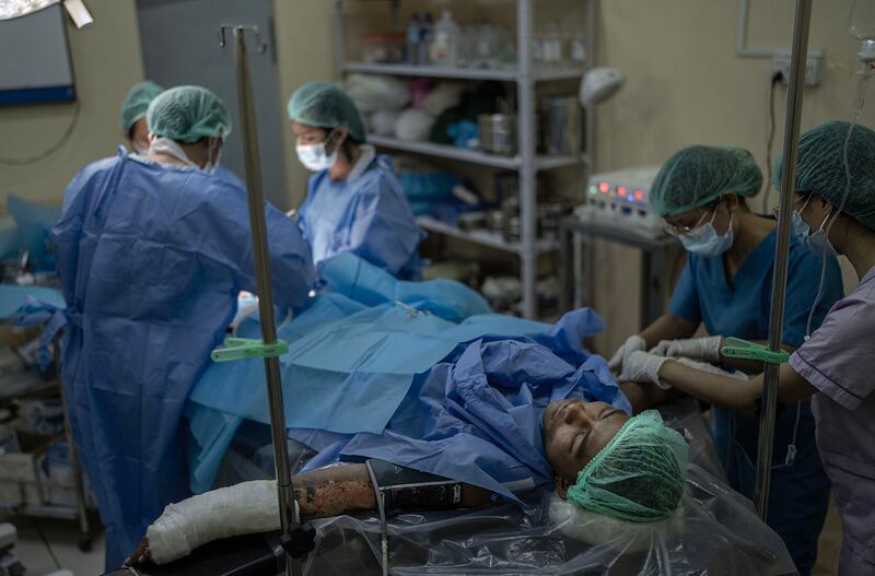 Dr. Aung Ko Myint amputates parts of both feet of Victorio, a KNDF fighter, at O-1 hospital, in Demoso, Kayah state, Myanmar, Nov. 5, 2024.