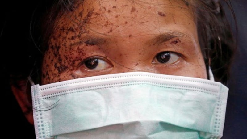 myanmar-wounded-person-flees-kayin-thailand-mar30-2021.jpg