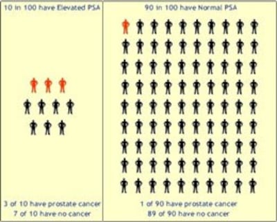 90 trên 100 người có PSA bình thường. Số người bị ung thư tuyến tiền liệt là 1 trên 90 người. Courtesy Virginia Commonwealth University
