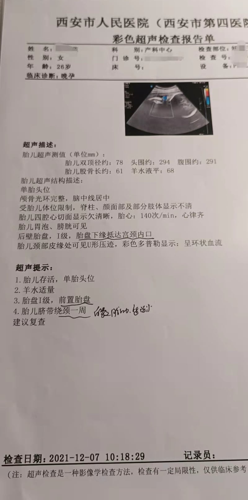 超声波显示产妇前置胎盘，期待绕颈一周。（网络截图）