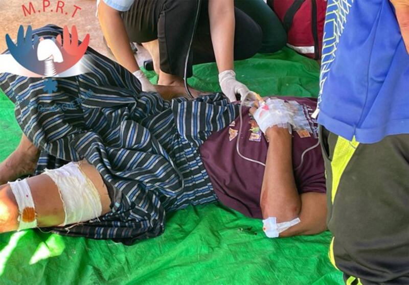 A civilian who sustained injuries during shelling by Myanmar soldiers is treated in Moebye township, southeastern Myanmar's Kayah state, Jul. 26, 2022. Credit: Mobye PDF Rescue Team