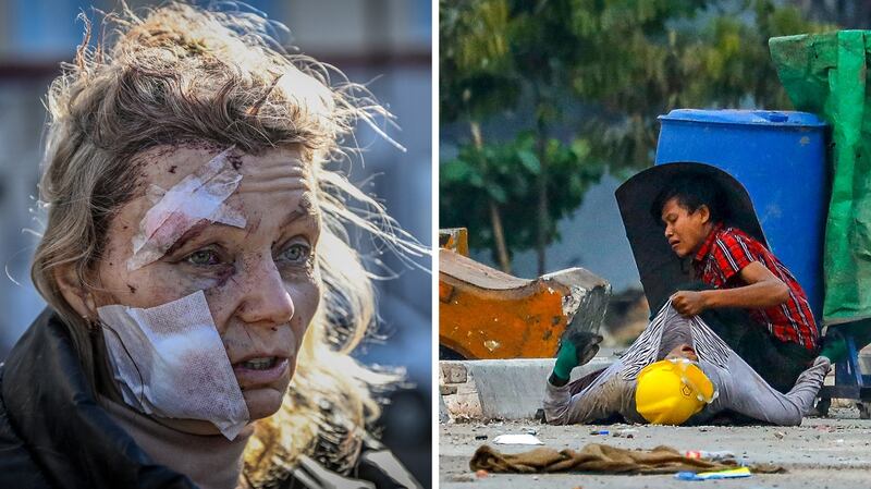 Left: A wounded woman stands outside a hospital after the bombing of the eastern Ukraine town of Chuguiv on February 24, 2022, as Russian armed forces invade Ukraine. Credit: AFP Right: A protester holds onto the shirt of a fallen comrade, during a crackdown by security forces on demonstrations against the military coup, in Hlaing Tharyar township in Yangon, March 14, 2021. Credit: AFP